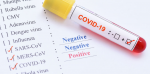 Lietuvos draudikų asociacija informuoja dėl koronaviruso pandemijos draudiminės rizikos